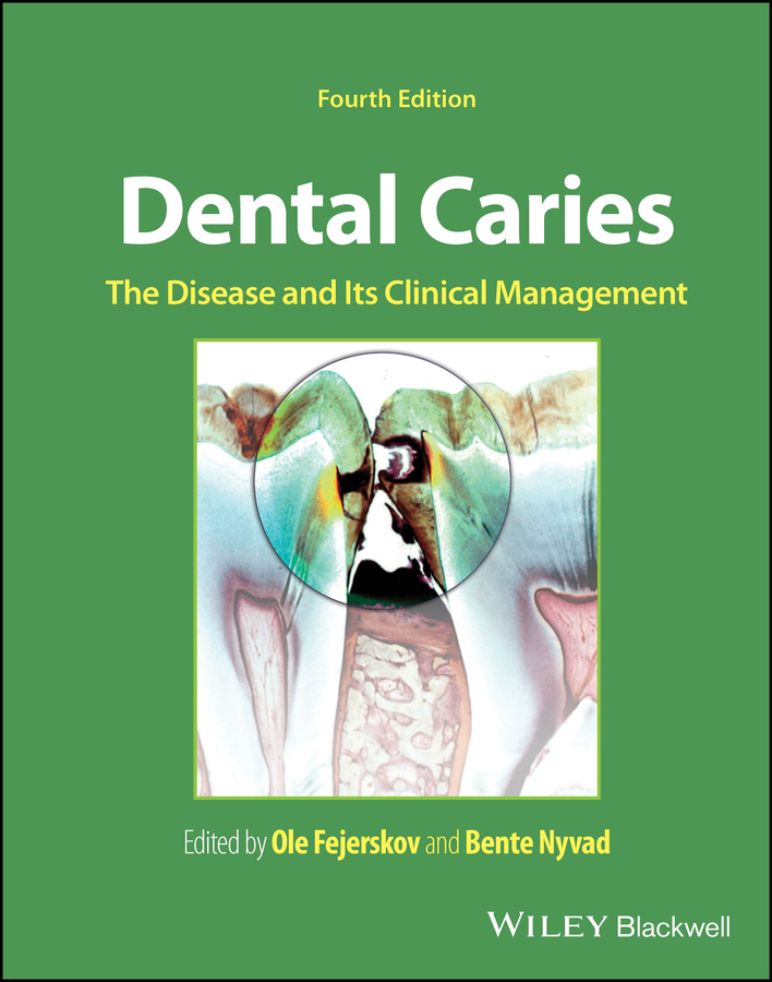 Dental Caries: The Disease And Its Clinical Management, 4th Edition 封面